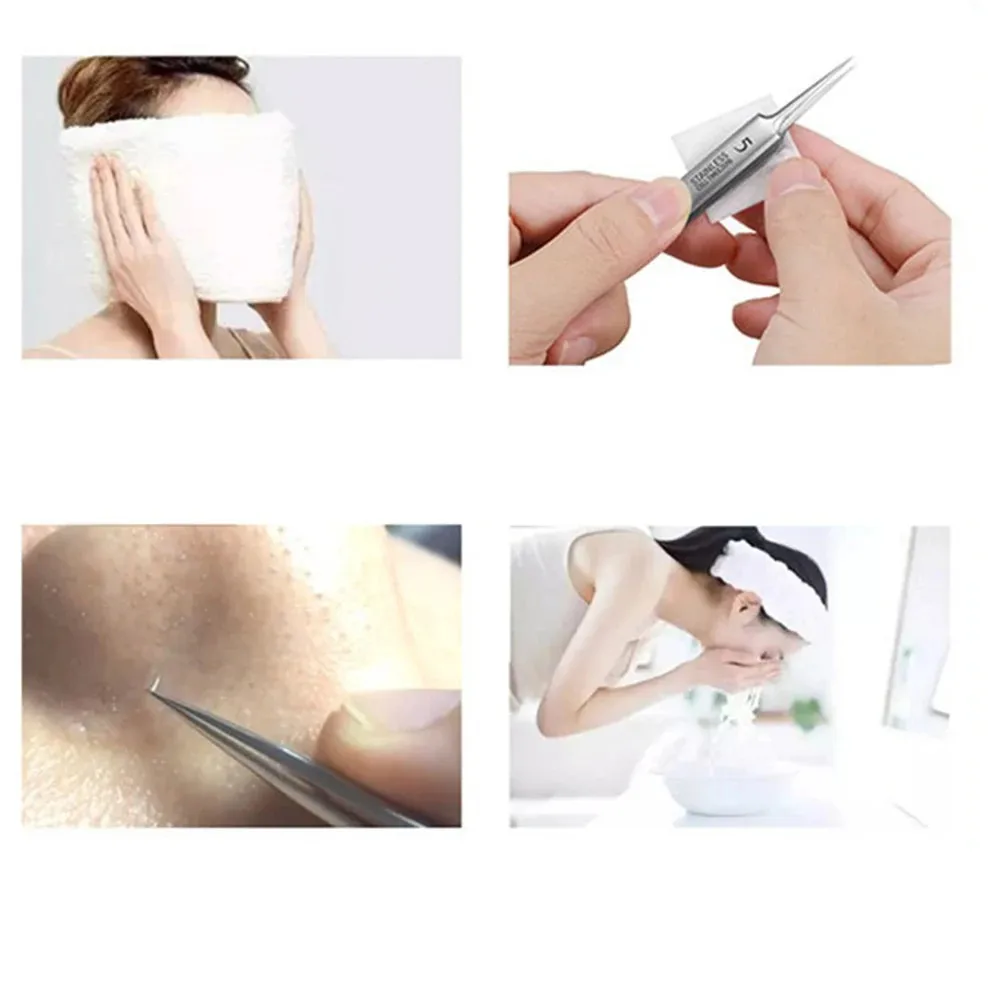 Alemão Ultra-Fine Blackhead Clip, Espinhas celular Pinças, Prego Gems Vara, Especial Raspagem e Fechando Artefato, Acne Ferramenta Agulha, No.5