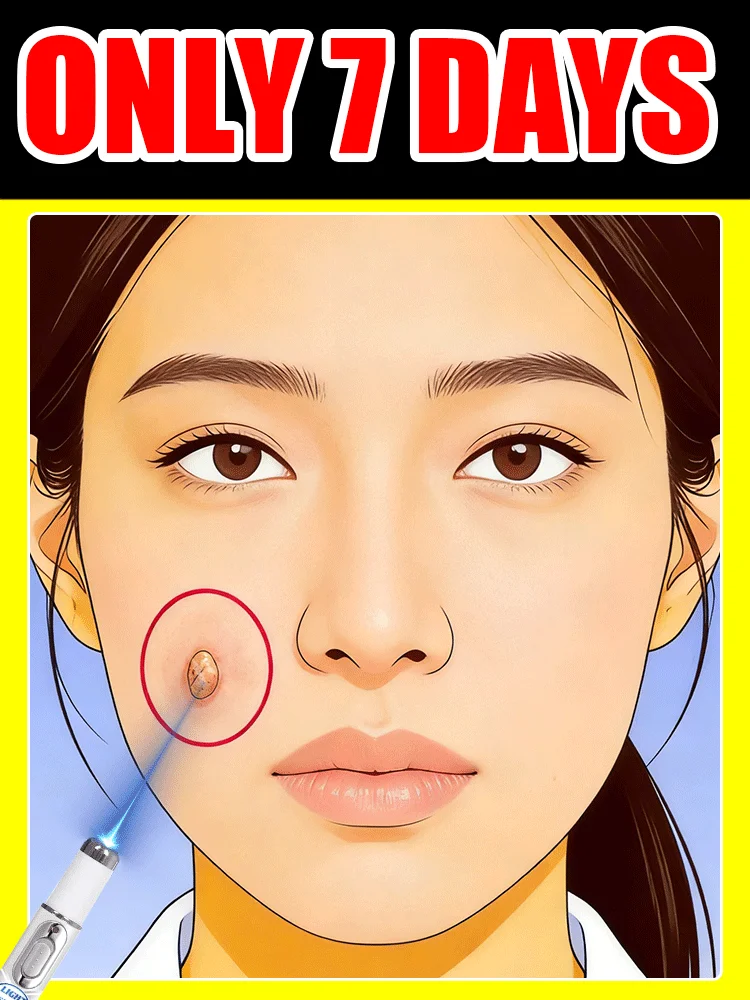 

Устройство для удаления бородавок с синим светом, плюс скидки на комплекты