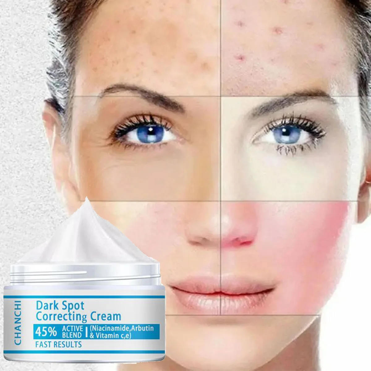 hyaluronic acid cream to lighten acne marks skin care  firming skin tightening cream