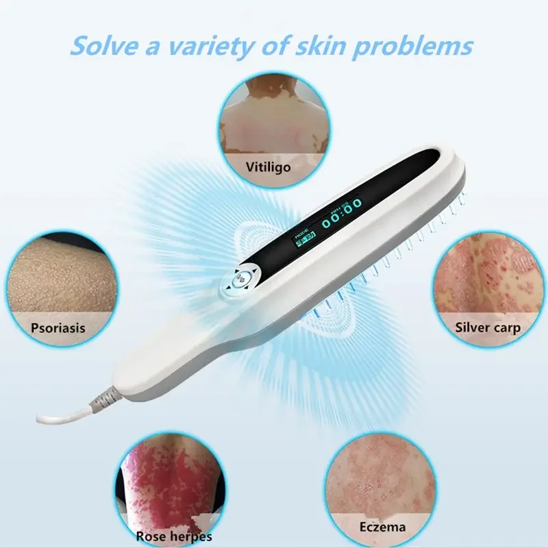 311nm UVB Phototherapy Lamp Recommended by Dermatologists for Skin Treatment