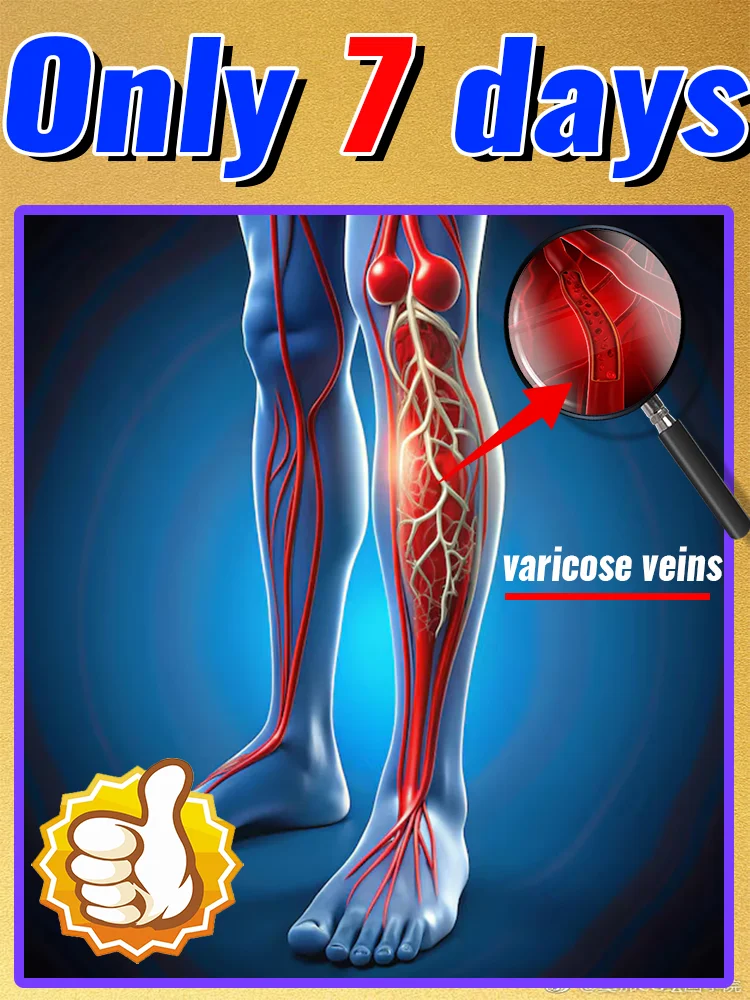 Reverse leg health and say goodbye to ᵛᵃʳⁱᶜᵒˢᵉ ᵛᵉⁱⁿˢ ⁱⁿ ⁷ ᵈᵃʸˢ
