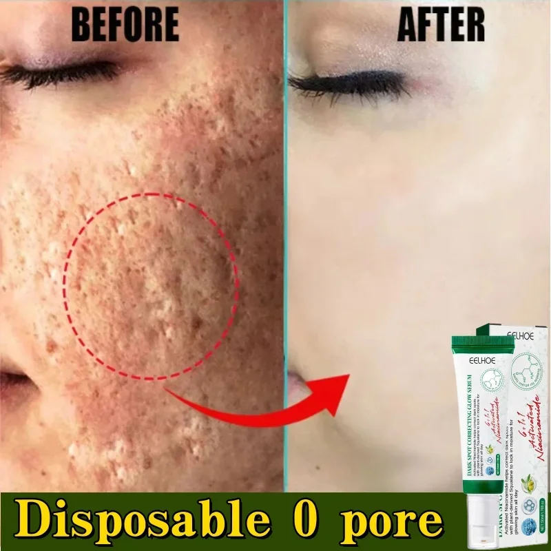 

Pore Shrinking Cream Acne Pit Repair Product for Men Women Remove Acne Print Scar Large Pore Anti-inflammatory Smooth Skin Cream