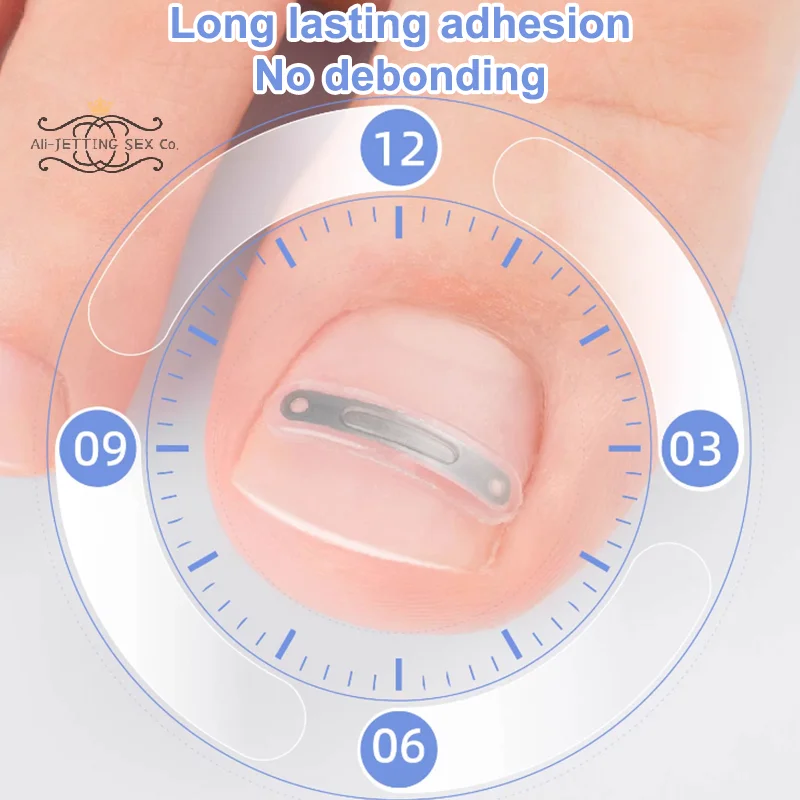 نام أظافر تصحيح نام تو علاج الأظافر رقعة مرنة ملصق استقامة كليب هدفين باديكير أداة العناية بالأظافر