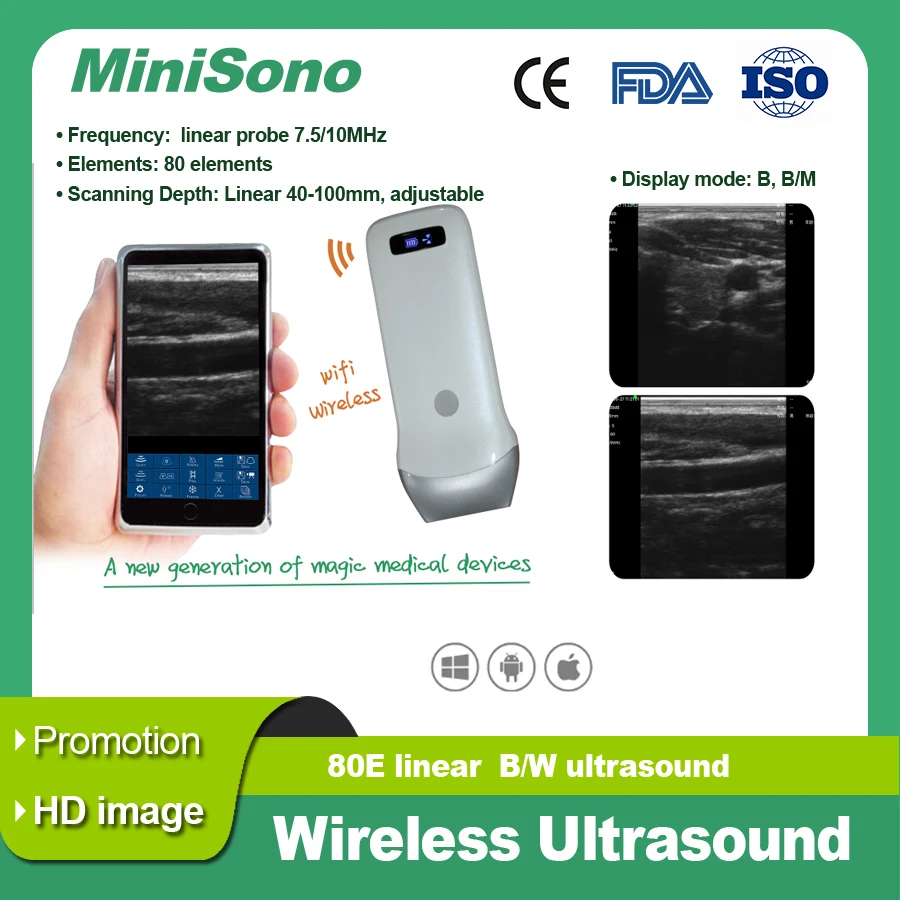 

Palm Ultrasound Wireless Probe, Convex Linear,80E， Factory Supply