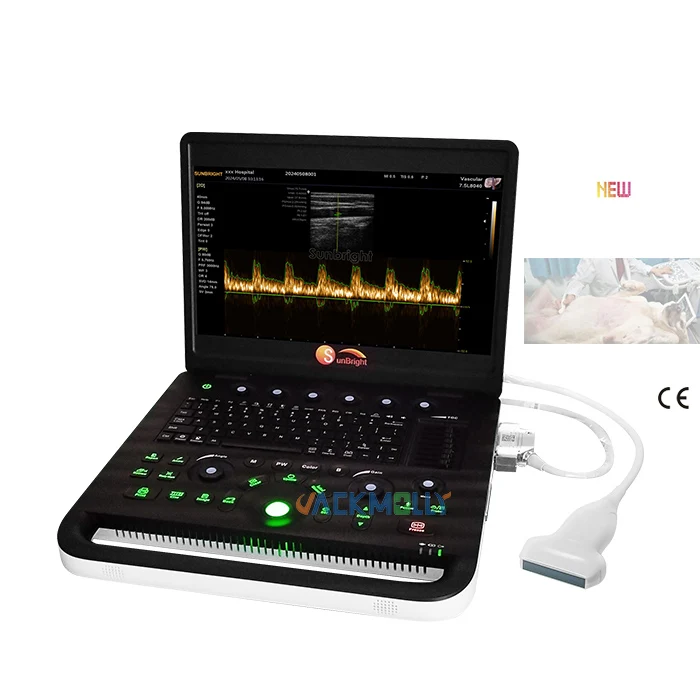 Échographe Doppler PW SUN-800C à haute performance et longue autonomie pour les cliniques rurales et les services de santé communautaire