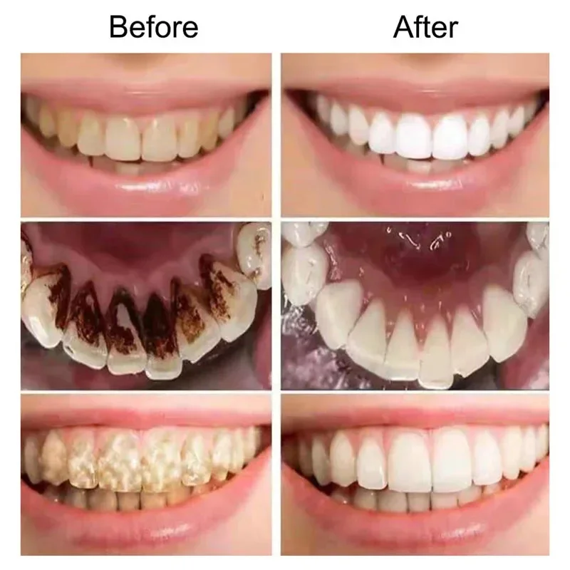 V34 púrpura blanqueamiento Dental pasta de dientes eliminación manchas humo placa de café blanqueador de dientes Corrector limpio cuidado de lejía