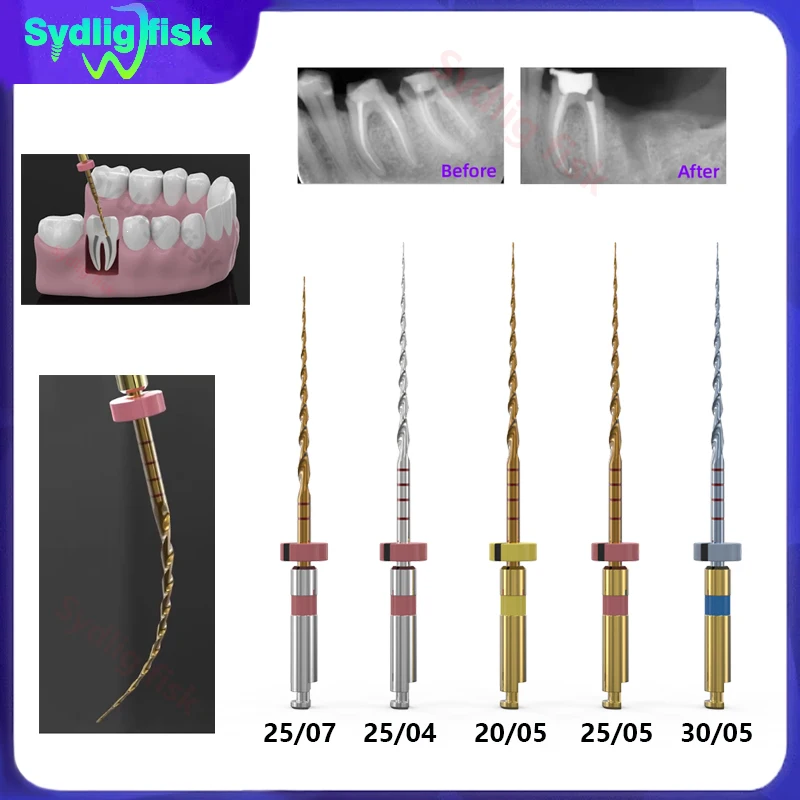 5Pc Dental Re-treatment Files Engine Canal Root Files Treatment Rotary File Can Bend Taper Endodontic Files Cleaning Dentist Use