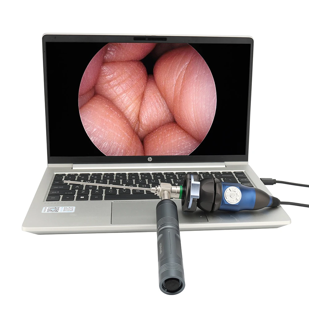 Factory delivery  full HD Endoscope Camera 1080P , HDMI Medical portable endoscope camera unit Endoscope camera ENT