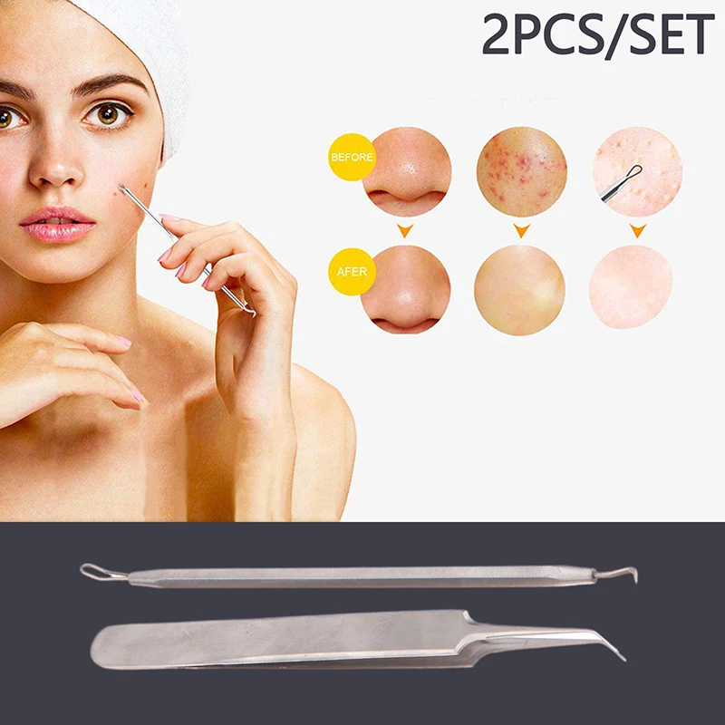 2Pcs/Set Blackhead Remover Comedone Acne Stick Pimple Extractor For Faces Black Dots Tweezers Beauty Facial Skin Care Tools