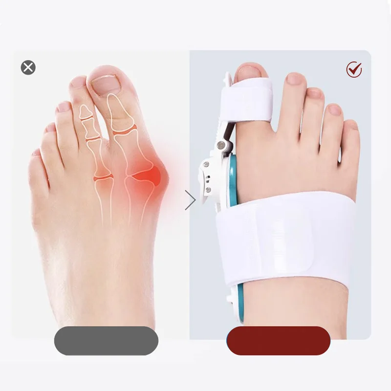 Toe Separator Bunion Corrector Bunions Haluksy Separators Halux Toe Spreader Finger Straightener For Toe Hallux Valgus Corrector