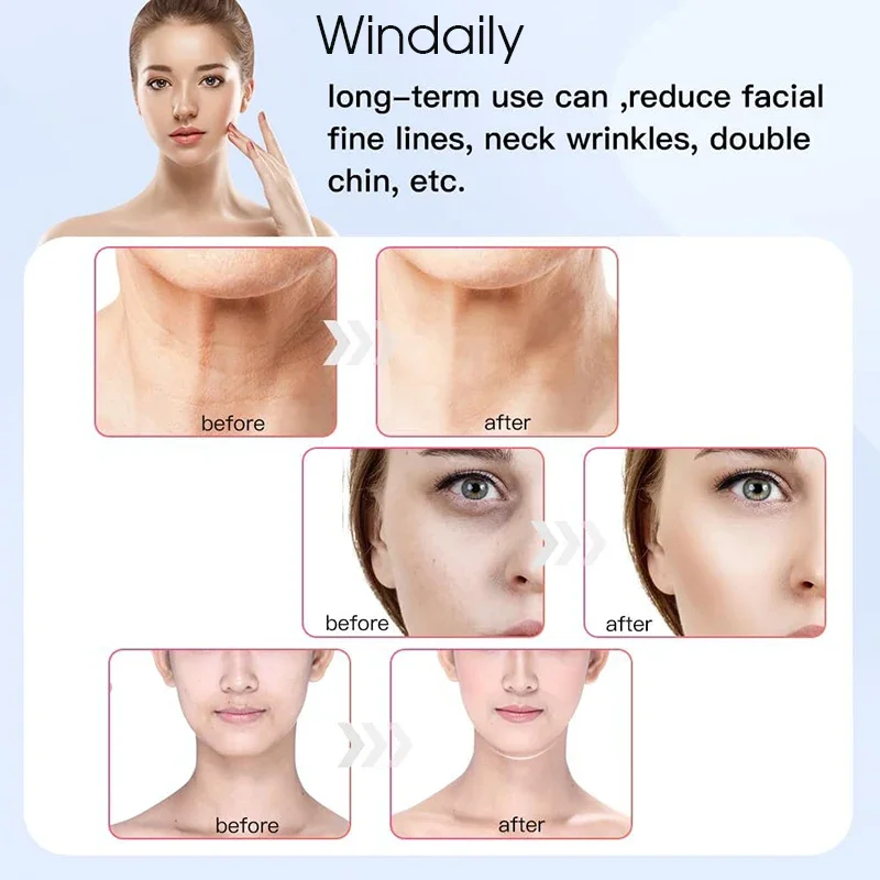 อุปกรณ์ยกคอใบหน้าการสั่นสะเทือน EMS เครื่องนวดหน้า LED Light Therapy เครื่องกระชับผิวริ้วรอย Remover Skin Care เครื่องมือ