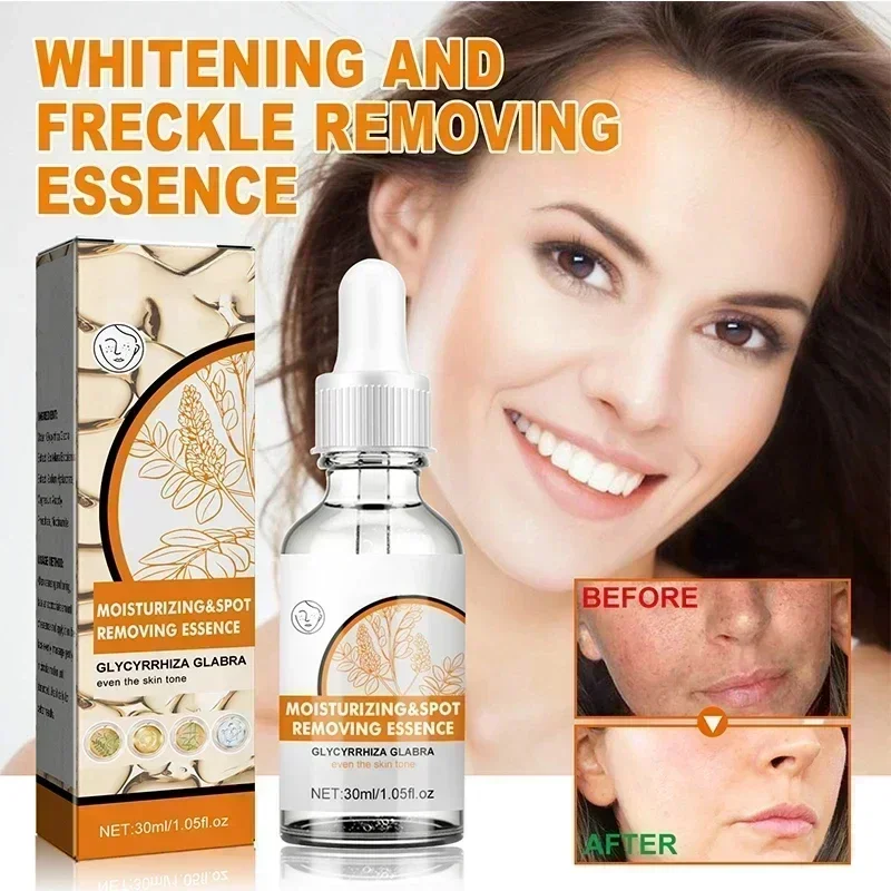 Niacynamid Dark Spots Remover Serum Freckle Whitening Moisture Powerful Removal Black Dot Melasma Chloasma Face Skin Care Cream