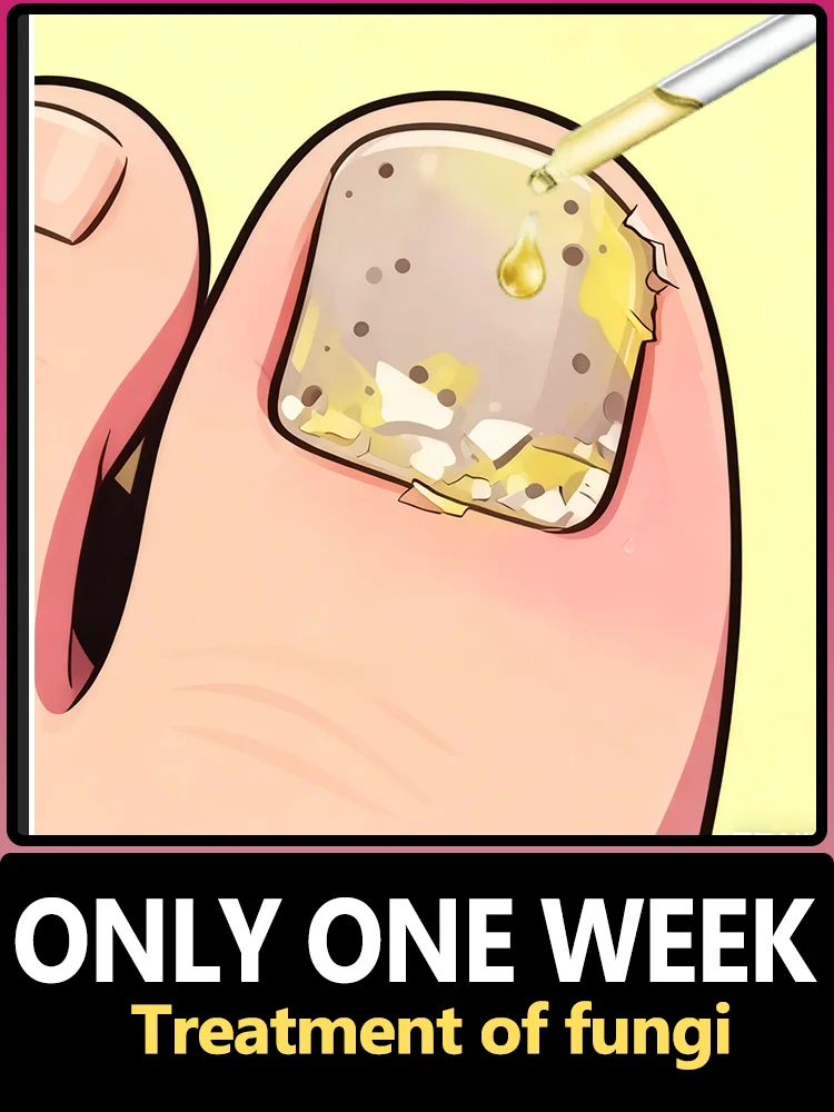 

The "color change" crisis in the cornerᴮˡᵒᶜᵏ ᶠᵘⁿᵍᵃˡ ⁱⁿᶠᵉᶜᵗⁱᵒⁿ ᵃⁿᵈ ᶜᵘʳᵉ ᑫᵘⁱᶜᵏˡʸ