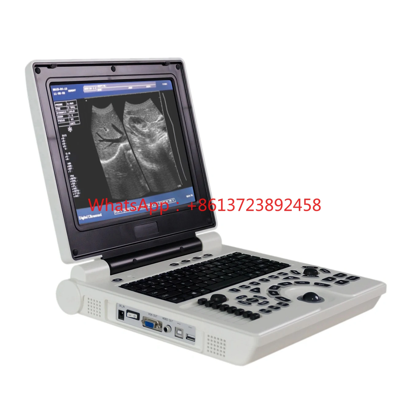 Ultrasonic Diagnostic Instruments Portable Ultrasound Device B W Ultra sound