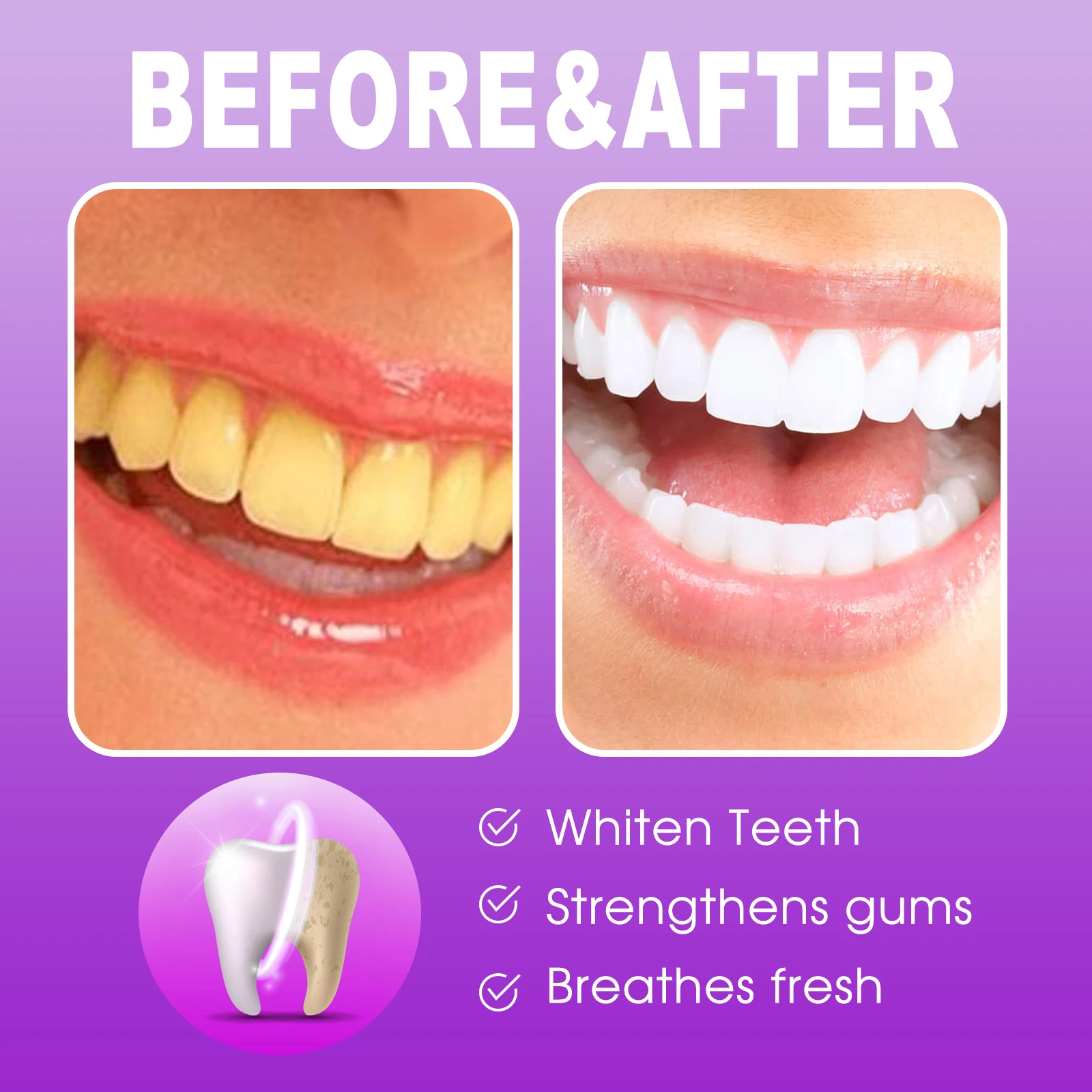 Probiotics Brightening Toothpaste Cleaning Stain Removal Freshens Breath Gentle Daily Teeth Cleaning Promote Bright Smiles - view 5