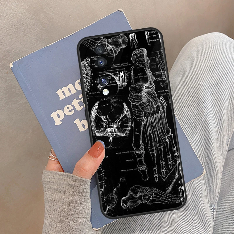 حافظة تشريح الهيكل العظمي الطبي لهاتف Honor Magic 8 7 6 5 Pro Cover For Honor 400 200 X9c X9b X9a X8a X8b 50 70 90 Lite