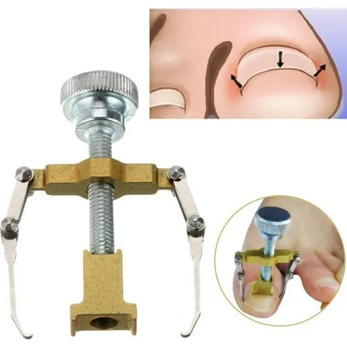 Professional ingrown nail fix bracket-wildlebend male female uses, manicure pedicure hand foot body care submerged