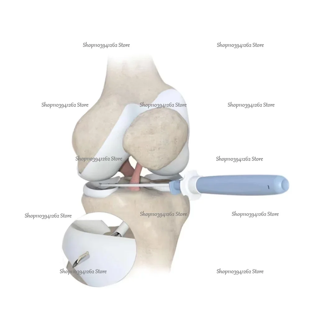 Interventional Materials For Orthopedc Surgery Well Design Arthrex Inside-out Meniscal Repair Suture Needles Fast Fix Depuy