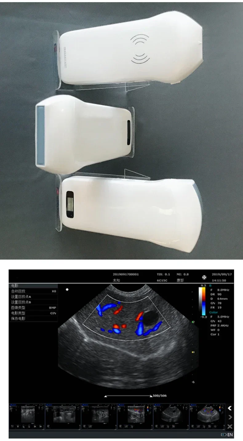 HF-K10 Mindray Ultraschall gerät Veterinär Ultraschall geräte zum Verkauf