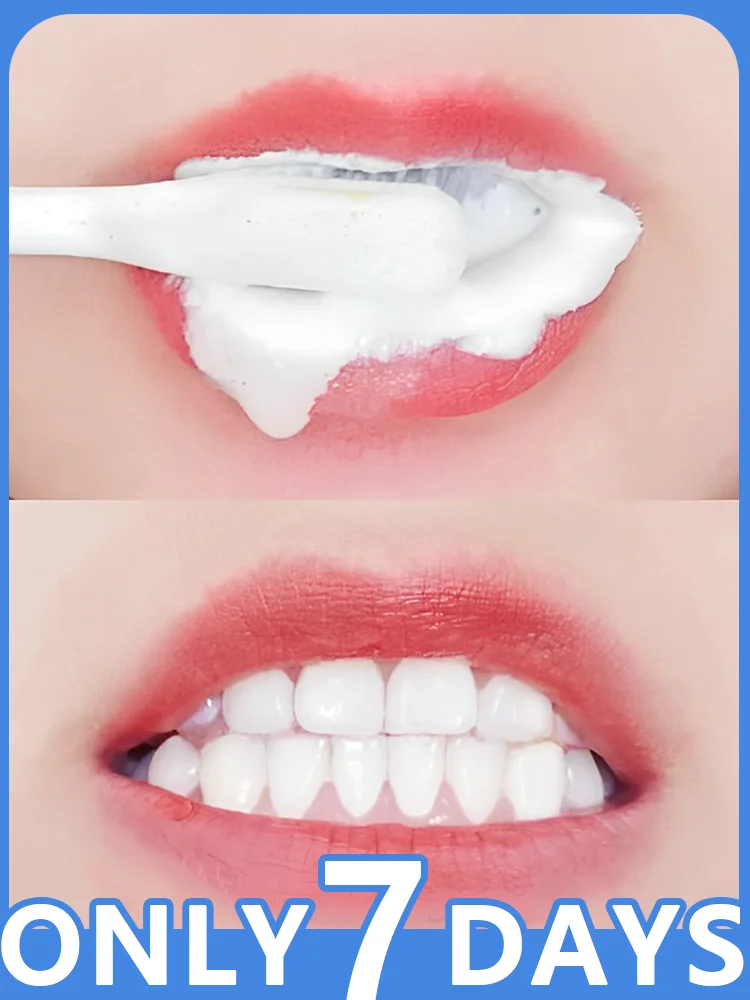 El mejor pasta de dientes blanqueadora y antiamarilla en 2025