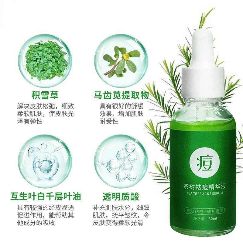 30ml Acne removing essence of alternate leaf white tea tree can eliminate acne, fade acne marks and refine pores essence 1pcs