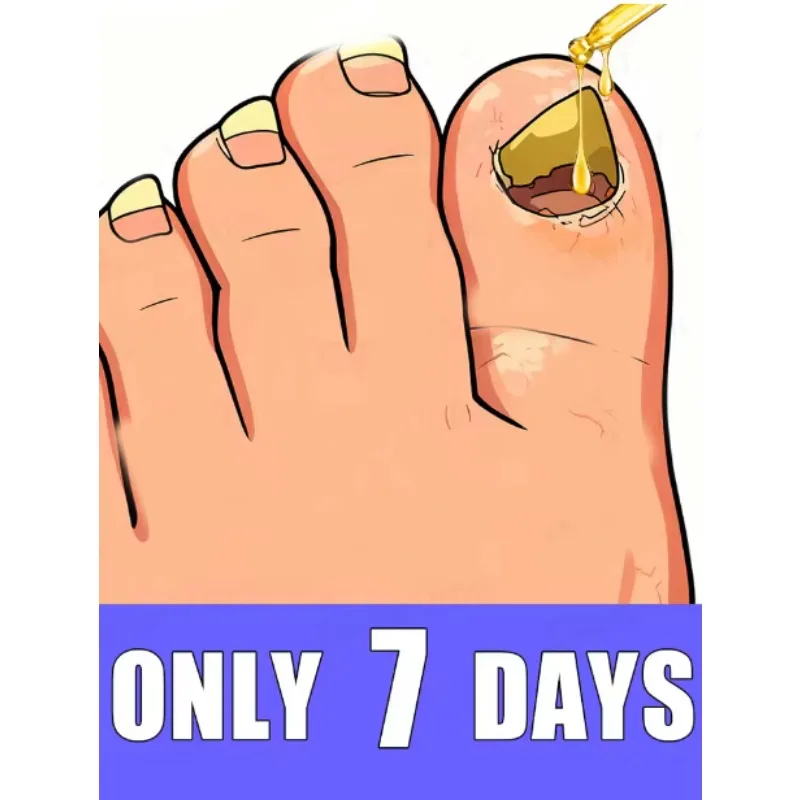 

Restore your nails' natural shine in 7 days