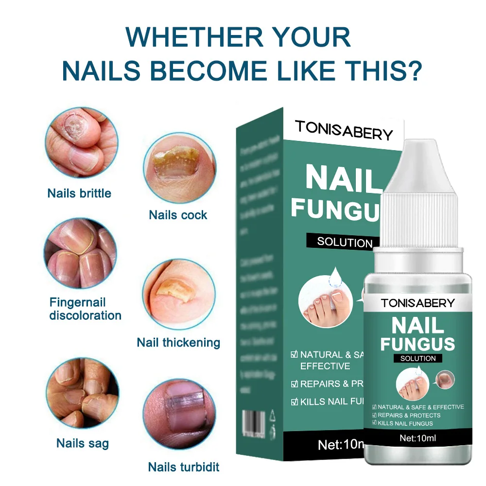 Nail Fungal Treatment Feet Care Essence Anti Infection Onychomycosis Removal Toe Nails Foot Fungus Paronychia Nail Care Uñas