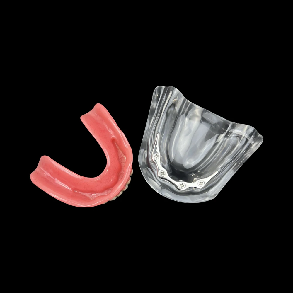 Dental Overdenture Implant Model Mandibular Implant Model with Silver Rod Type for Dental Technician Practice Training Studying