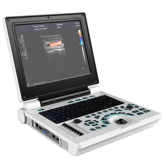 

High quality laptop color doppler medical ultrasound scanner for hospital use