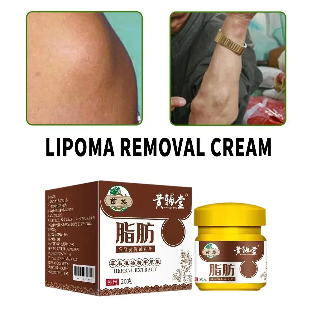 20g Lipoma Remover Treatment Cream Fat Mass Herbal Medicine Plaster Lumps Fibroma Multiple Lipomas Cellulite Body Health Care