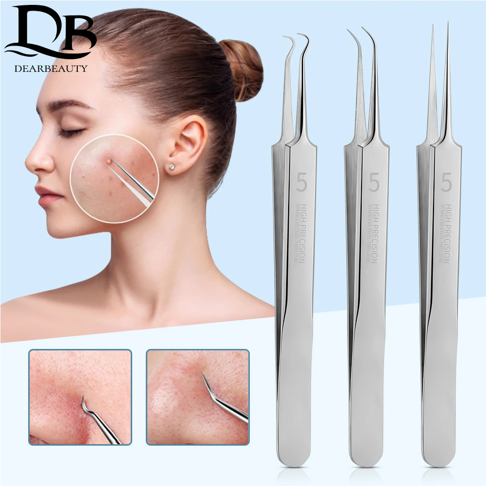 Acne Needle Set 3Pcs Stainless Steel Cell Clip Acne Clip Acne Needle Blackhead Removal Beauty Tools Skin Refreshing And Delicate