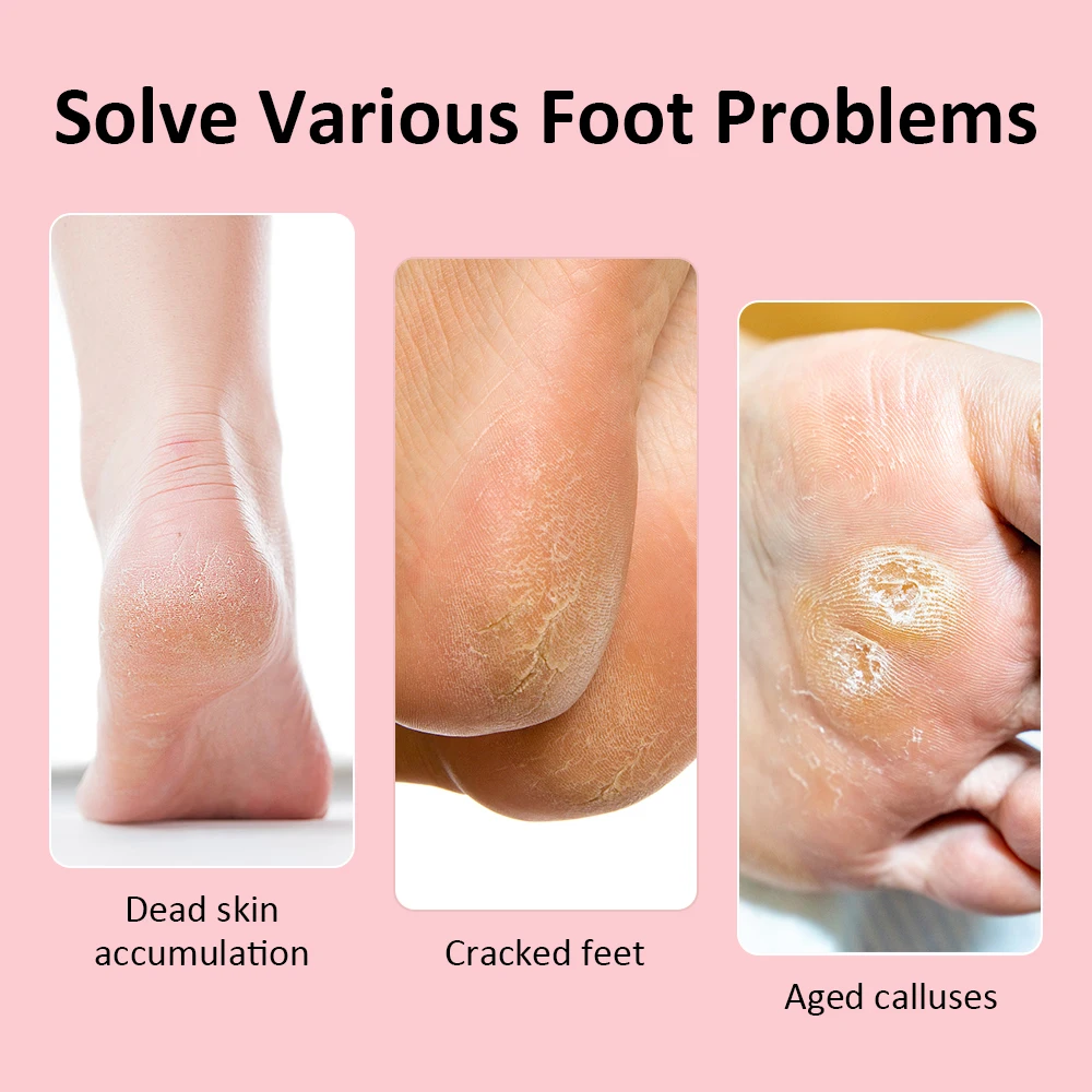 ไร้สายแฟ้มดูแลเท้าขารองเท้าส้นสูงลบ USB ชาร์จ Dead Skin Pedicure เครื่องมือเปลี่ยนกระดาษทราย Foot Care TOOL