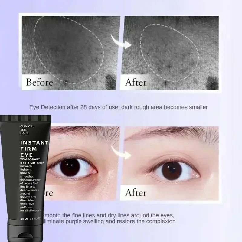 10 Instant Eye Bag Removal Cream Collagen Anti-Wrinkle Fade Fine Lines Firming Skin Anti Dark Circle Puffiness Brighten Eye Care