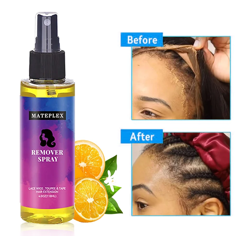 Haar Kleber Remover Schnell Wirkende Perücke Kleber Entferner Spray Band in Entferner Spray für Spitze Perücke Schließung Haarteil Toupet