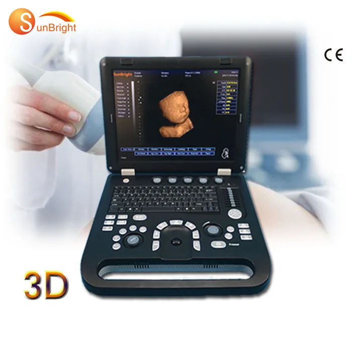 3D laptop portable medical ultrasound instruments veterinary