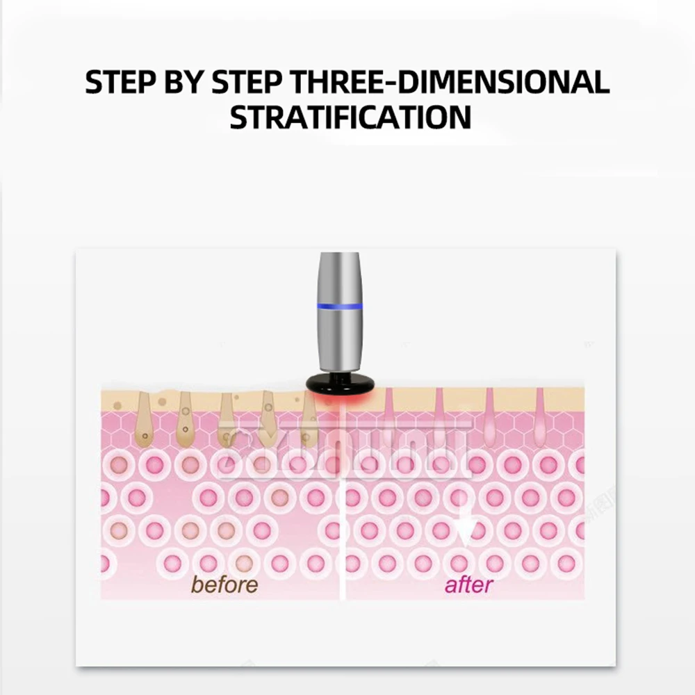 Facial Skin Lifting Firming Anti-Aging And Fine Lines Reduction Exclusive For Beauty Salons
