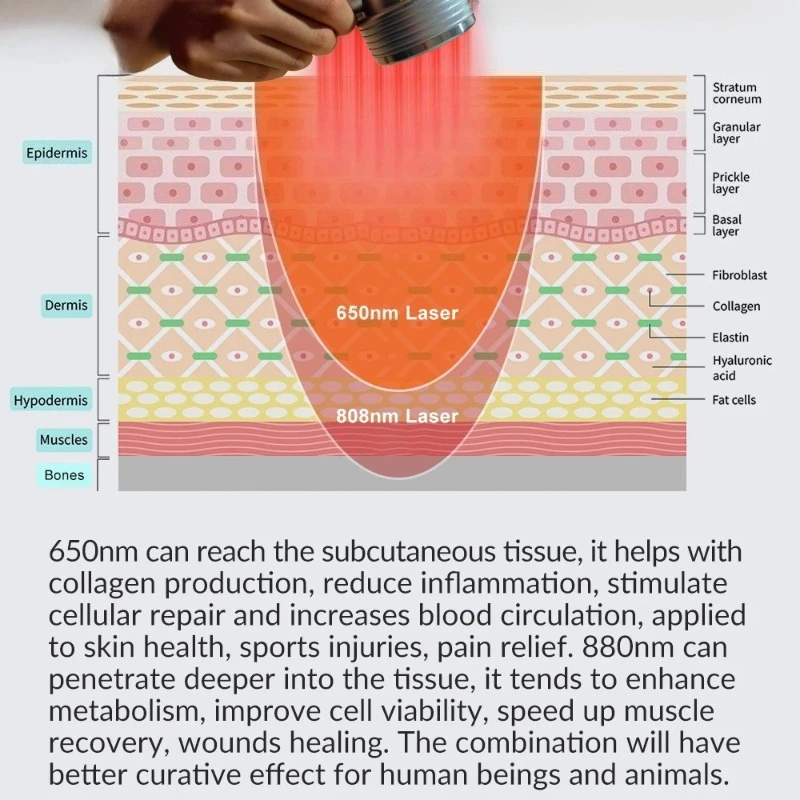 

650nm+808nm Laser Therapy Machine for Post-Operative Healing & Scar Reduction