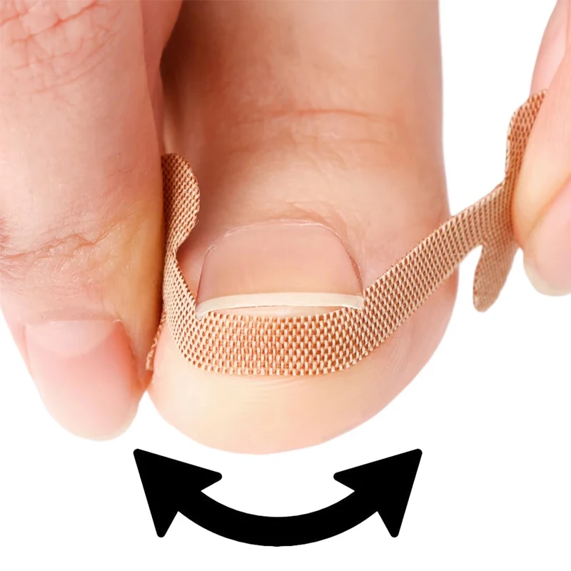 20-100pcs Adhesive Toenail Patch Ingrown Toe Nail Correction Sticker Foot Corrector Pedicure Health Care Tools Toe Treatment Pad - view 4