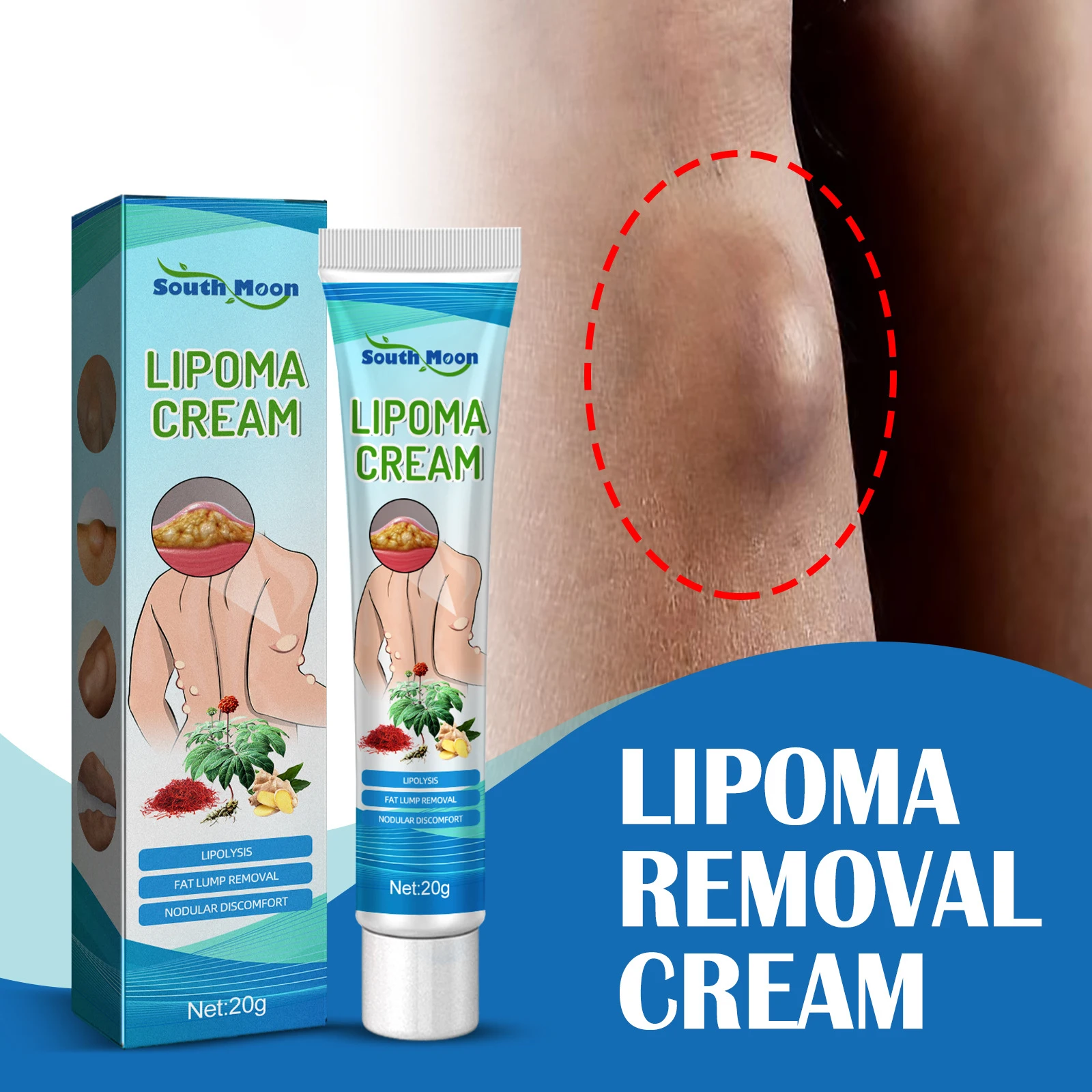 20g Lipoma Removal Cream Easy to Use Portable Ointment Mild Skin Friendly Fat Lump Removal Subcutaneous Lumps Cream Body Care