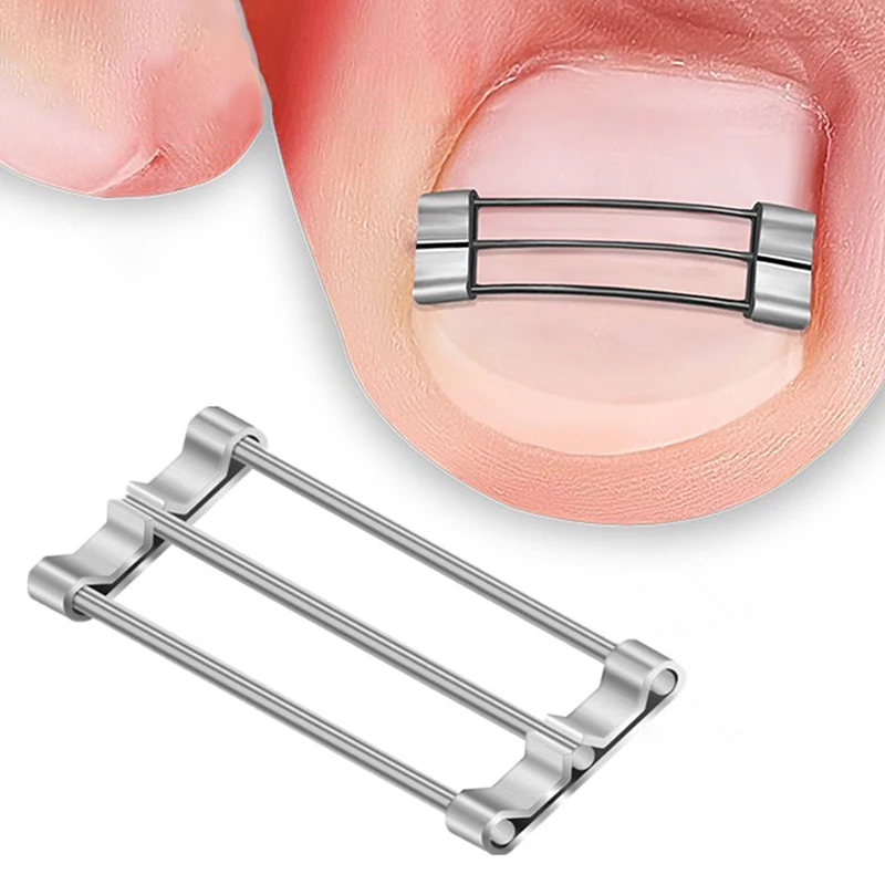 Ingrown Toenail Corrector Clip Brace Tools Pedicure Recover Embed Toe Nail Treatment Professional Ingrown Toenail Straightening
