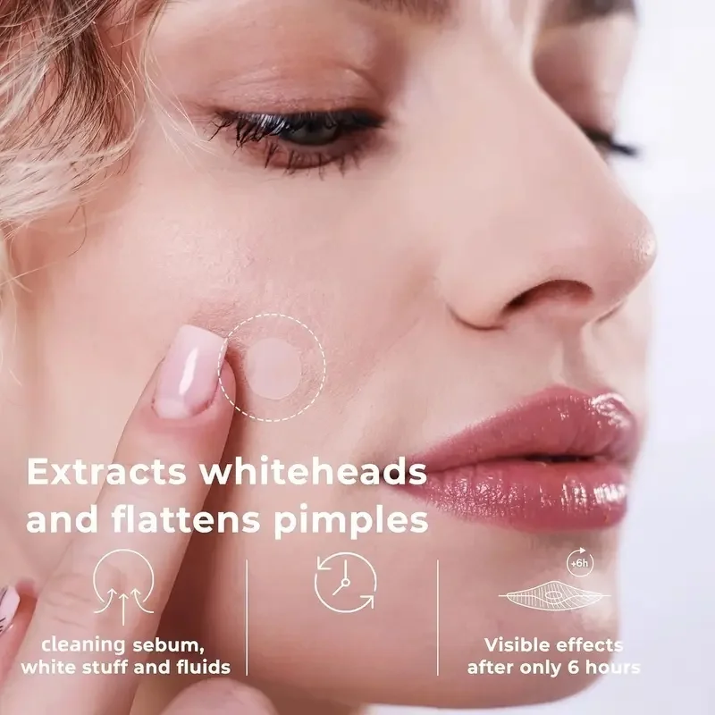 Overnight Micro-Dart Acne Patches - Dissolve Blemishes While You Sleep with Invisible Hydrocolloid Technology for AM Clear Skin.