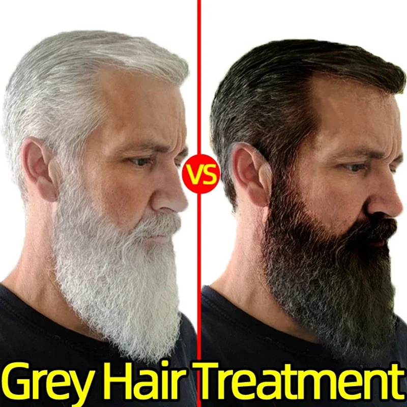 Natural Gray White Hair Treatment Shampoo White To Black Anti Gray Hair Dye Anti Loss Nourish Hair Care Products for Men Women