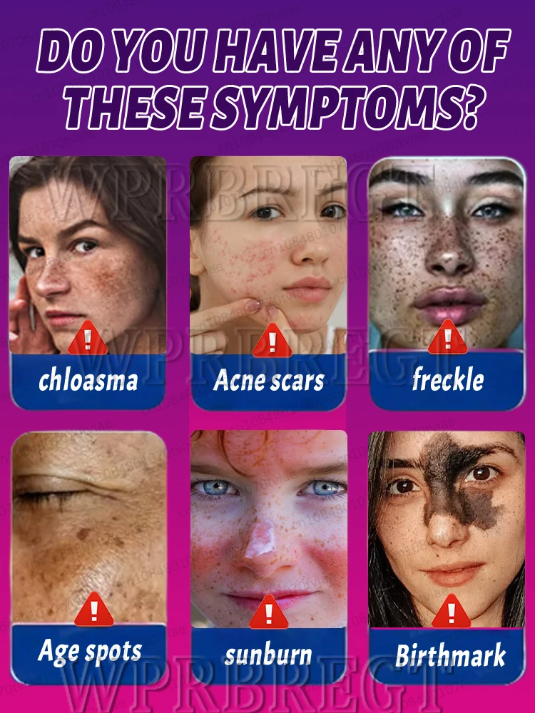 〔Hot sale〕Effectively solve the problem of ᴘɪɢᴍᴇɴᴛ ᴀᴄᴄᴜᴍᴜʟᴀᴛɪᴏɴ and say goodbye to pigmentation