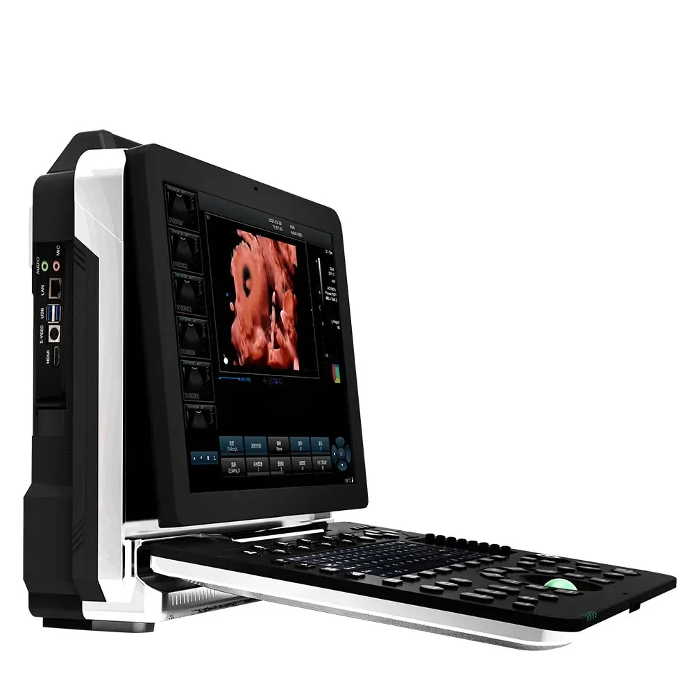 Color Doppler Portable Ultrasound Machine portable ultrasound scanner