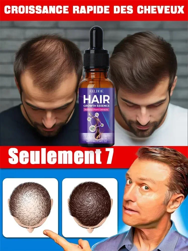 

Hot selling product, 99% of buyers buy again, have more and more hair, say goodbye to baldness, thick hair