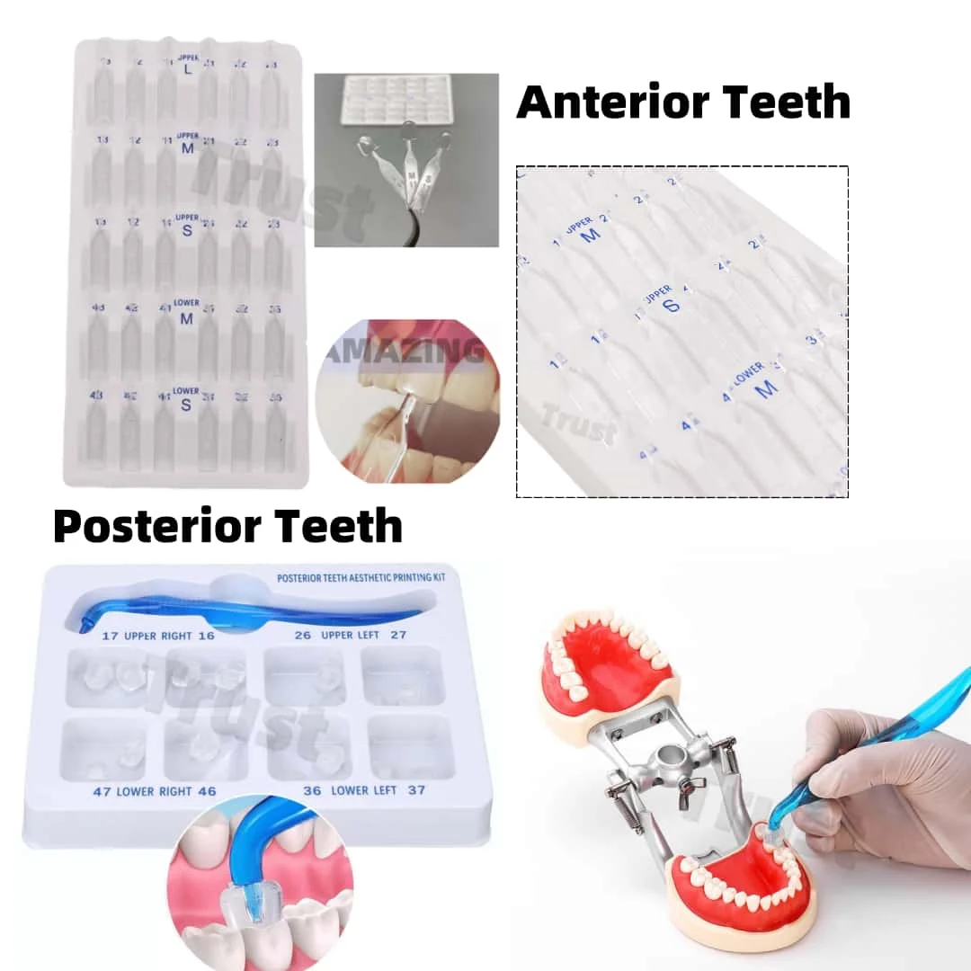 Dental Veneers Mould Composite Resin Anterior Posterior Teeth Molar Restoration Durable and Reliable Dental Prosthetics