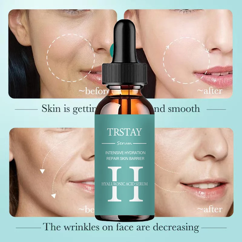 5ML/15ML/30ML/50ML/hyaluronic acid essence reduces fine lines, tightens skin, and improves damaged skin