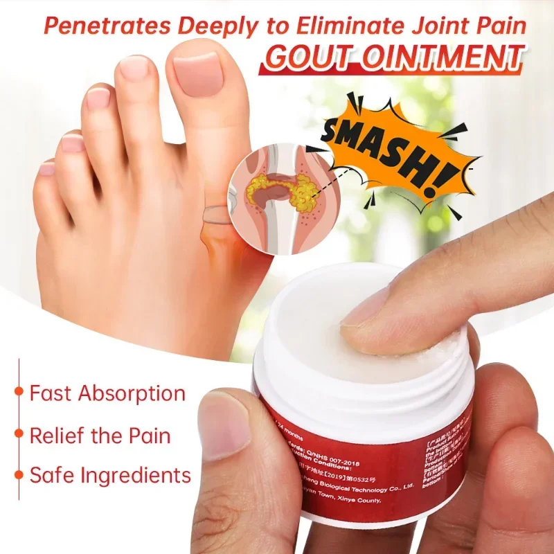 Gout Treatment Cream Arthritis Rheumatism Ointment Muscle Joints Toes knees Swelling Pain Relief Medical Plaster joint care