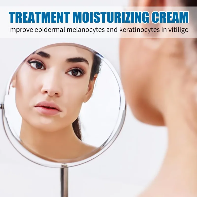 Vitiligo-Crème réparatrice contre les taches blanches naturelles, action rapide, pommade apaisante, soins de santé, 20g