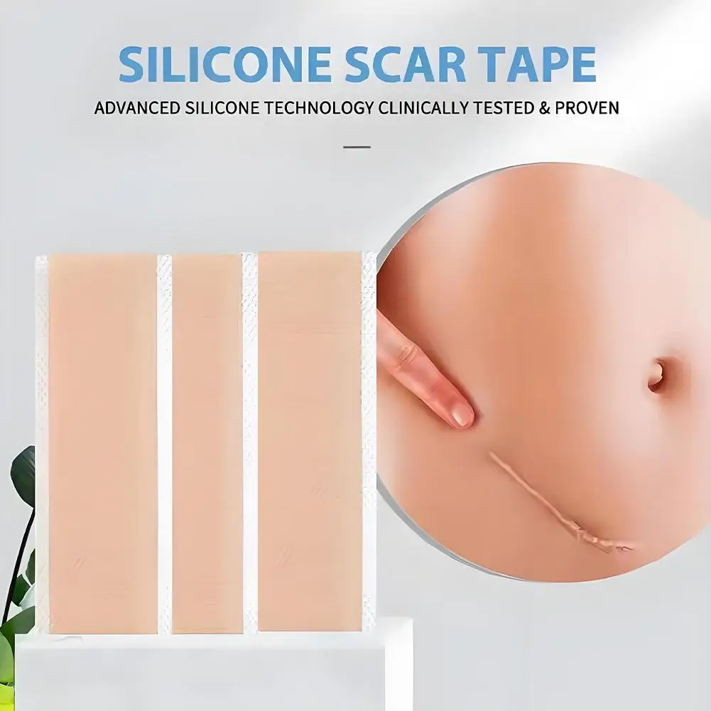 Silicone Scar Sheets Keloid Bump Removal Patch Acne Trauma Burn Cover Tape Skin Repair Strips Scars Reducing Treatment Skin Care